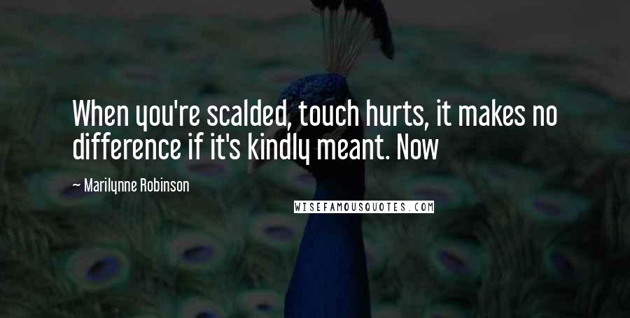 Marilynne Robinson Quotes: When you're scalded, touch hurts, it makes no difference if it's kindly meant. Now