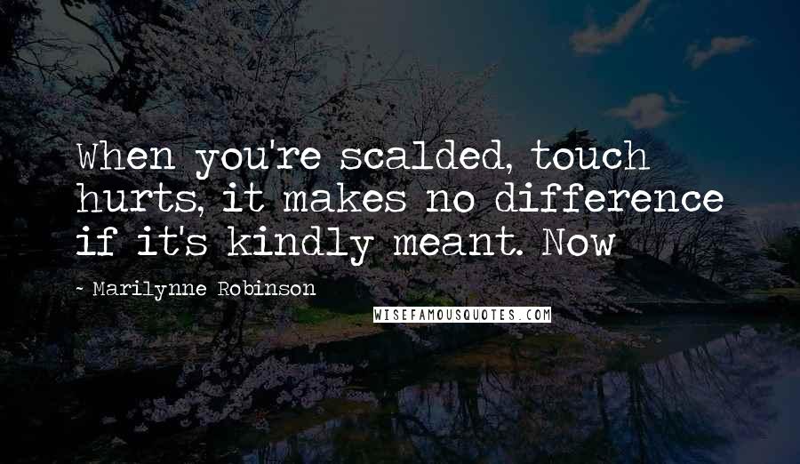 Marilynne Robinson Quotes: When you're scalded, touch hurts, it makes no difference if it's kindly meant. Now