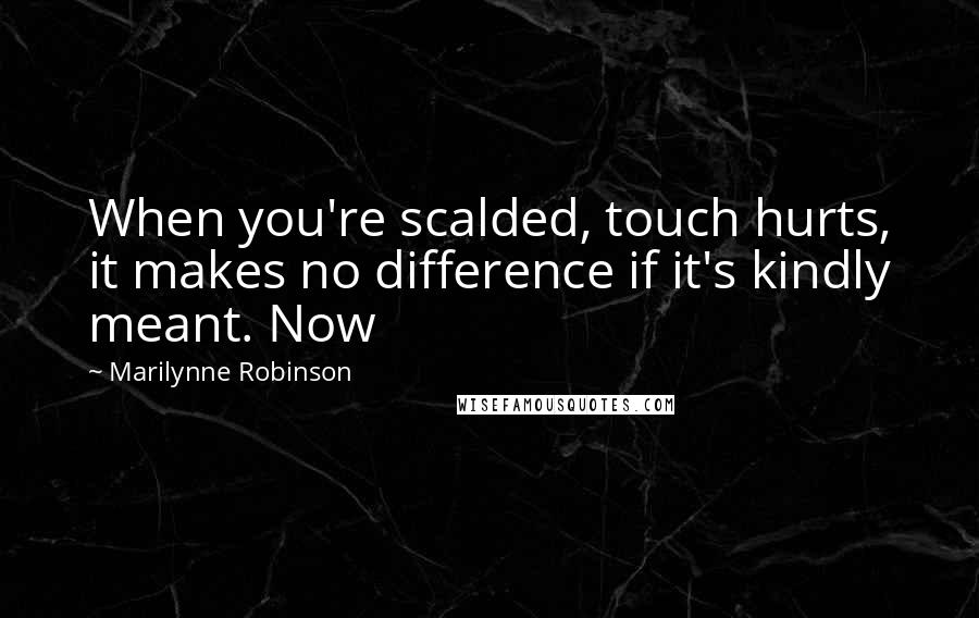 Marilynne Robinson Quotes: When you're scalded, touch hurts, it makes no difference if it's kindly meant. Now