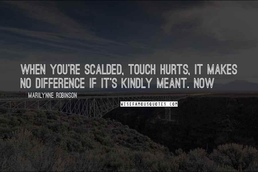 Marilynne Robinson Quotes: When you're scalded, touch hurts, it makes no difference if it's kindly meant. Now