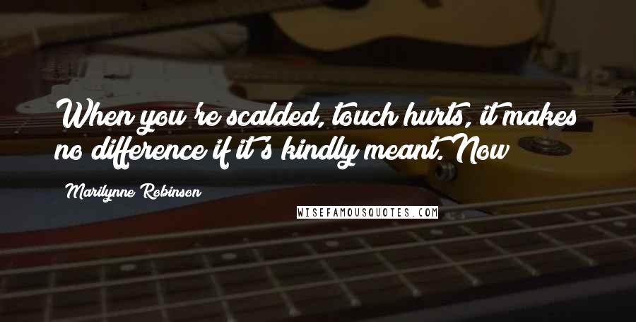 Marilynne Robinson Quotes: When you're scalded, touch hurts, it makes no difference if it's kindly meant. Now