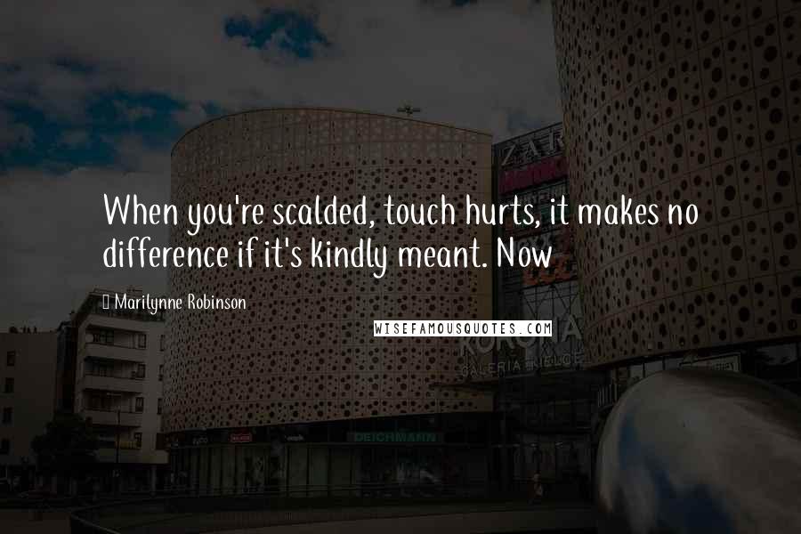 Marilynne Robinson Quotes: When you're scalded, touch hurts, it makes no difference if it's kindly meant. Now