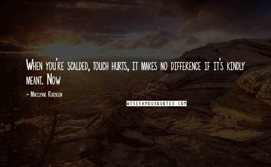 Marilynne Robinson Quotes: When you're scalded, touch hurts, it makes no difference if it's kindly meant. Now