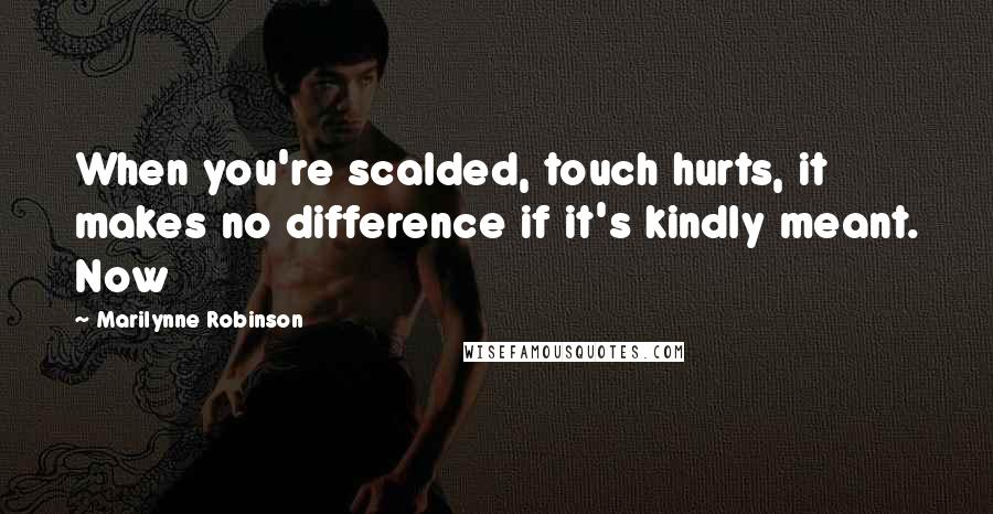 Marilynne Robinson Quotes: When you're scalded, touch hurts, it makes no difference if it's kindly meant. Now