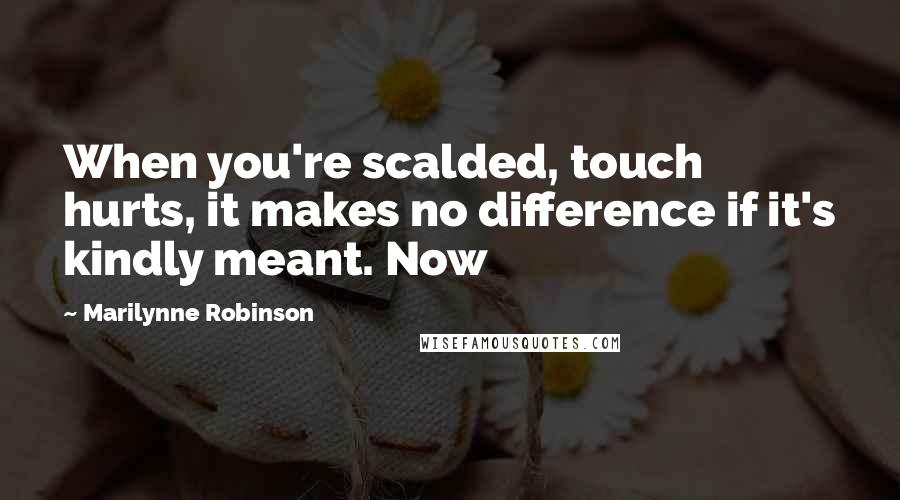 Marilynne Robinson Quotes: When you're scalded, touch hurts, it makes no difference if it's kindly meant. Now