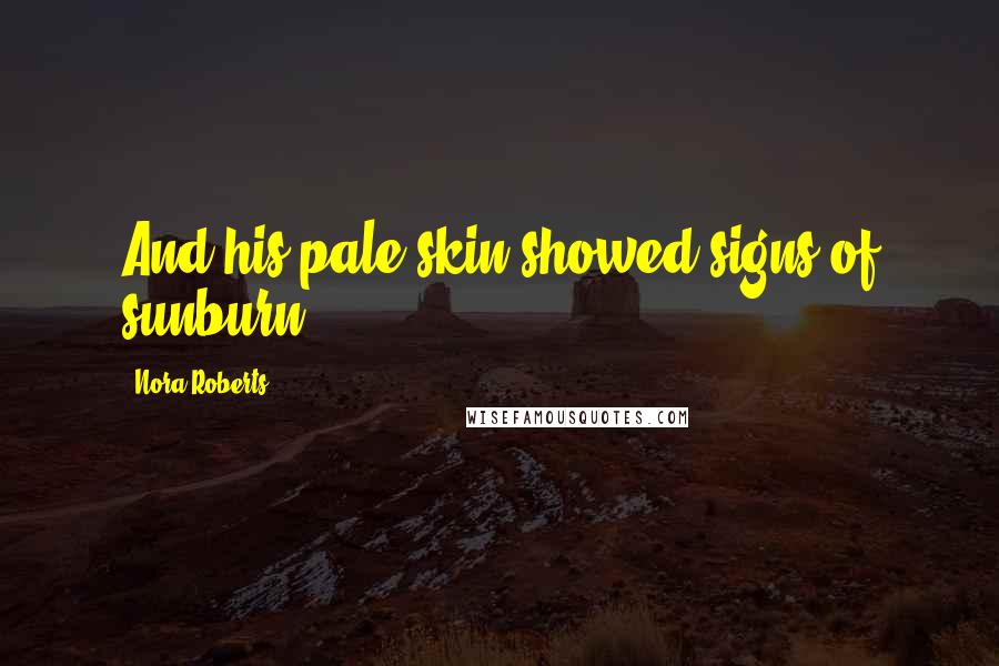 Nora Roberts Quotes: And his pale skin showed signs of sunburn.