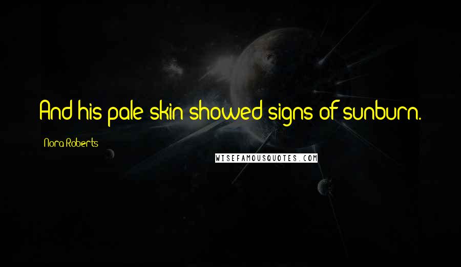 Nora Roberts Quotes: And his pale skin showed signs of sunburn.