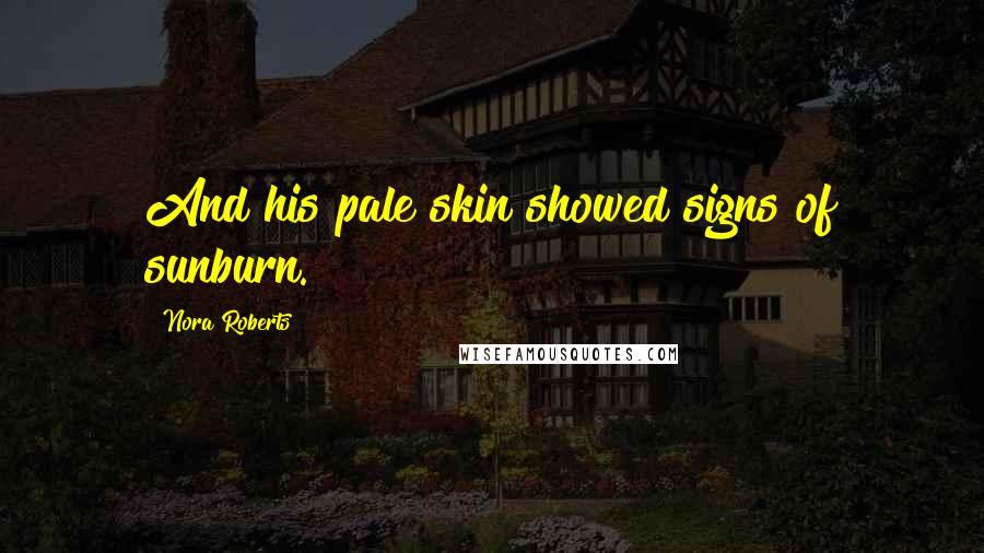 Nora Roberts Quotes: And his pale skin showed signs of sunburn.