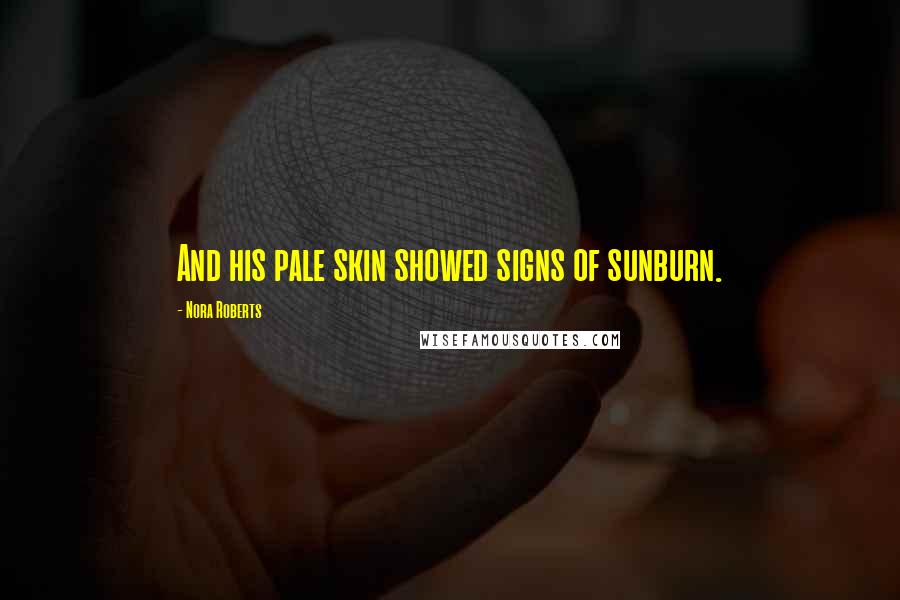 Nora Roberts Quotes: And his pale skin showed signs of sunburn.