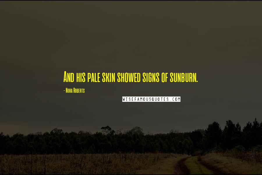 Nora Roberts Quotes: And his pale skin showed signs of sunburn.