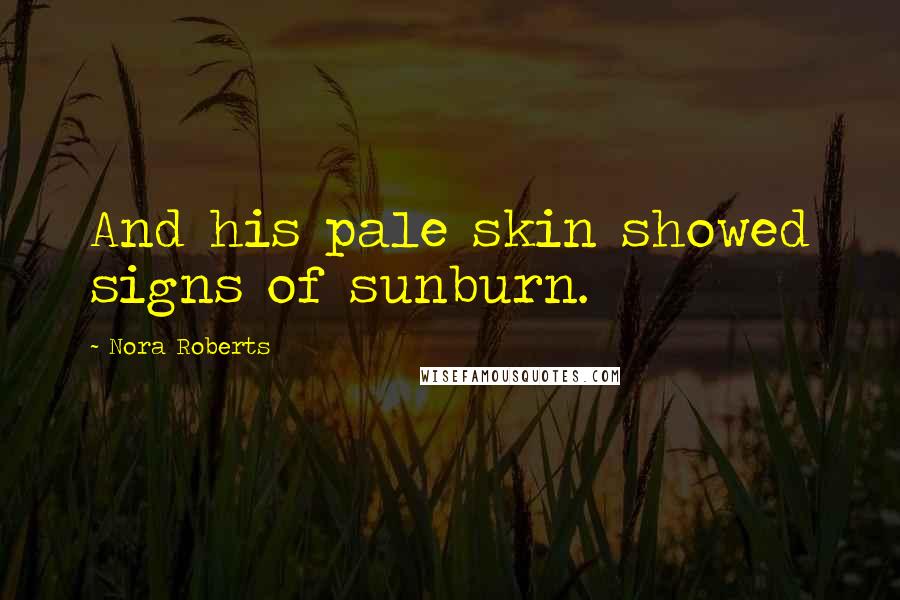 Nora Roberts Quotes: And his pale skin showed signs of sunburn.