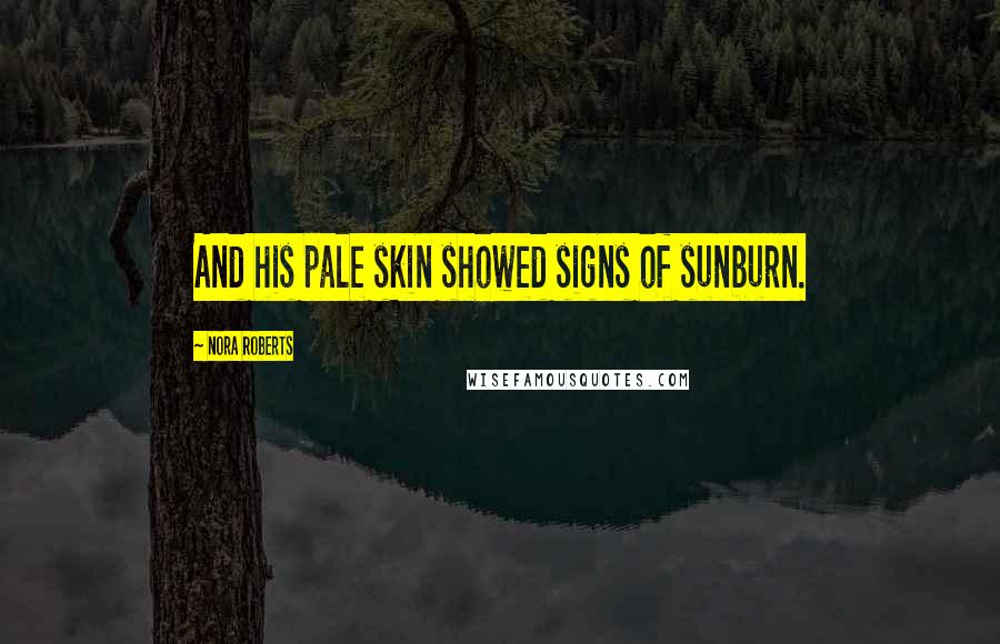 Nora Roberts Quotes: And his pale skin showed signs of sunburn.