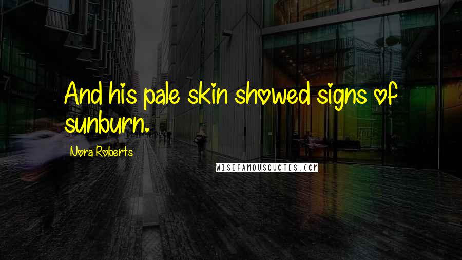 Nora Roberts Quotes: And his pale skin showed signs of sunburn.