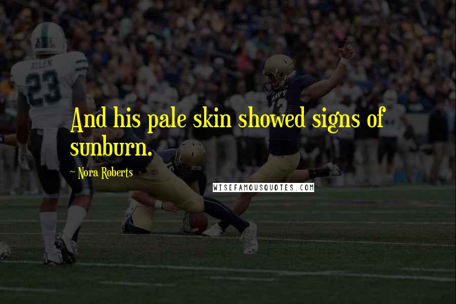 Nora Roberts Quotes: And his pale skin showed signs of sunburn.