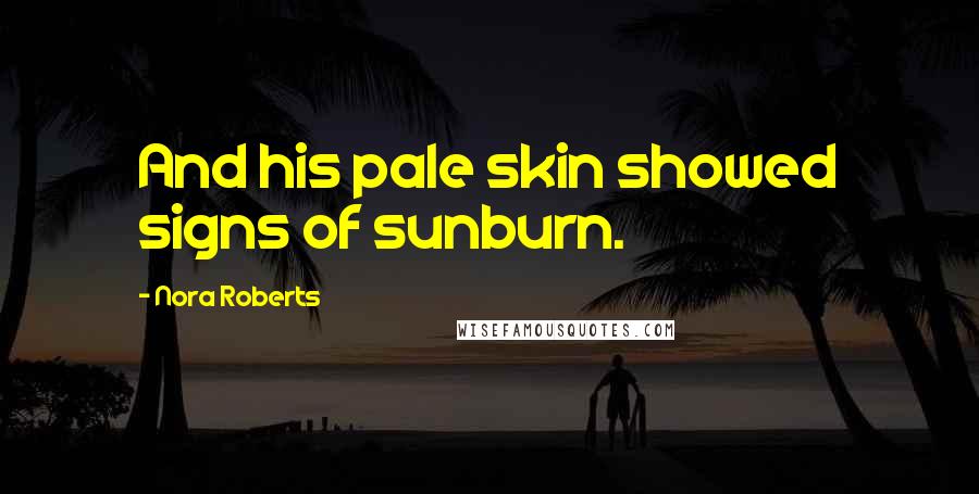 Nora Roberts Quotes: And his pale skin showed signs of sunburn.