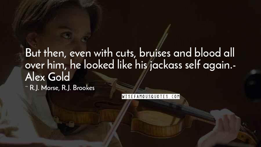 R.J. Morse, R.J. Brookes Quotes: But then, even with cuts, bruises and blood all over him, he looked like his jackass self again.- Alex Gold