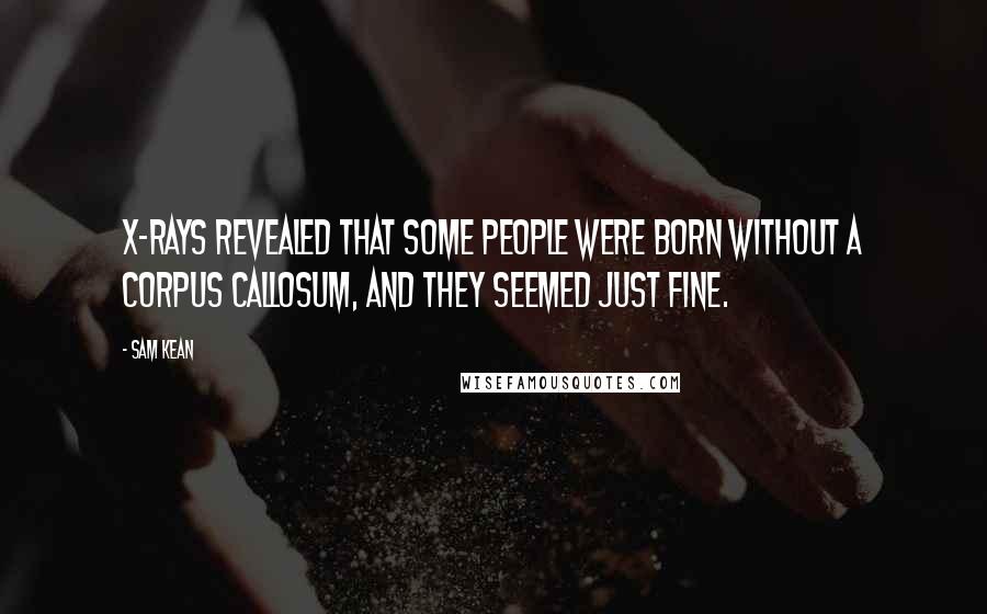 Sam Kean Quotes: X-rays revealed that some people were born without a corpus callosum, and they seemed just fine.