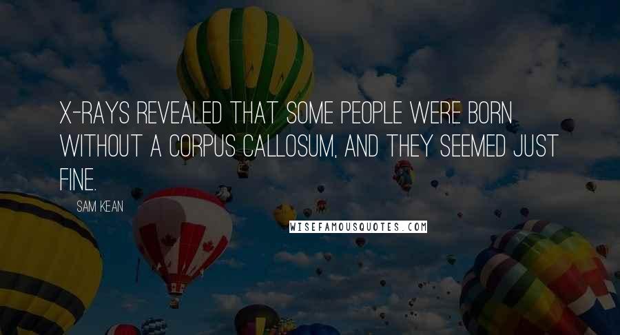 Sam Kean Quotes: X-rays revealed that some people were born without a corpus callosum, and they seemed just fine.