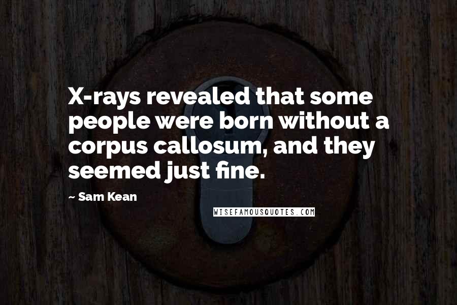 Sam Kean Quotes: X-rays revealed that some people were born without a corpus callosum, and they seemed just fine.
