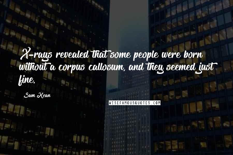 Sam Kean Quotes: X-rays revealed that some people were born without a corpus callosum, and they seemed just fine.