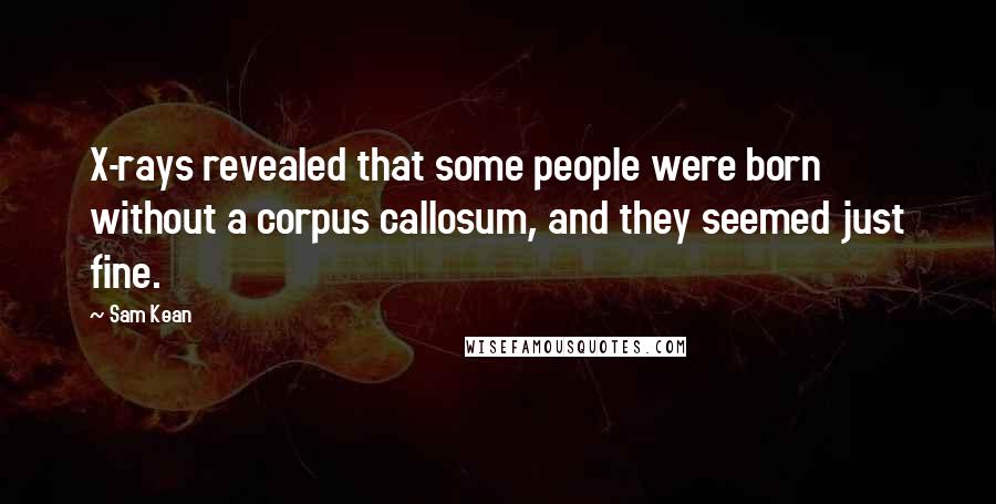 Sam Kean Quotes: X-rays revealed that some people were born without a corpus callosum, and they seemed just fine.