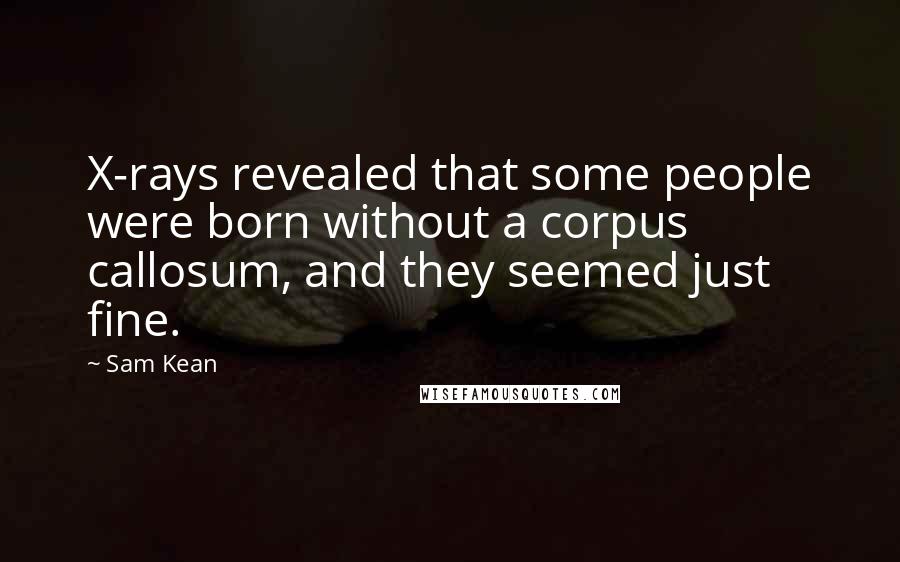 Sam Kean Quotes: X-rays revealed that some people were born without a corpus callosum, and they seemed just fine.