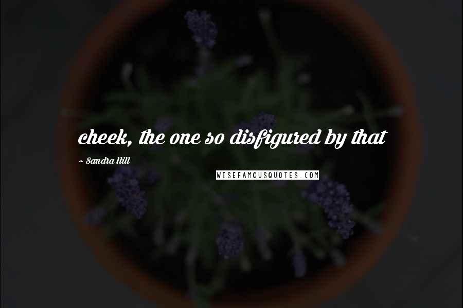 Sandra Hill Quotes: cheek, the one so disfigured by that