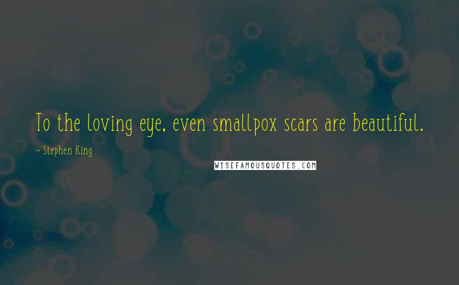 Stephen King Quotes: To the loving eye, even smallpox scars are beautiful.