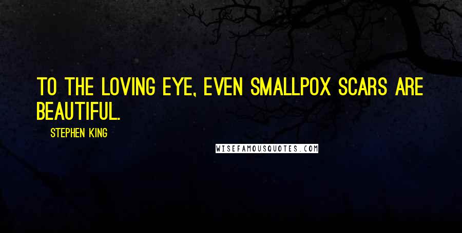 Stephen King Quotes: To the loving eye, even smallpox scars are beautiful.