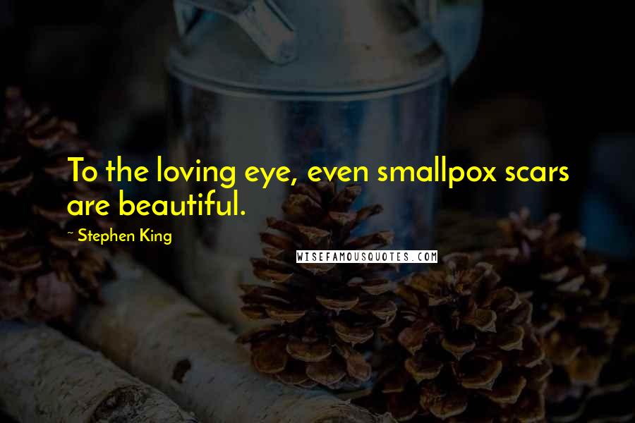 Stephen King Quotes: To the loving eye, even smallpox scars are beautiful.