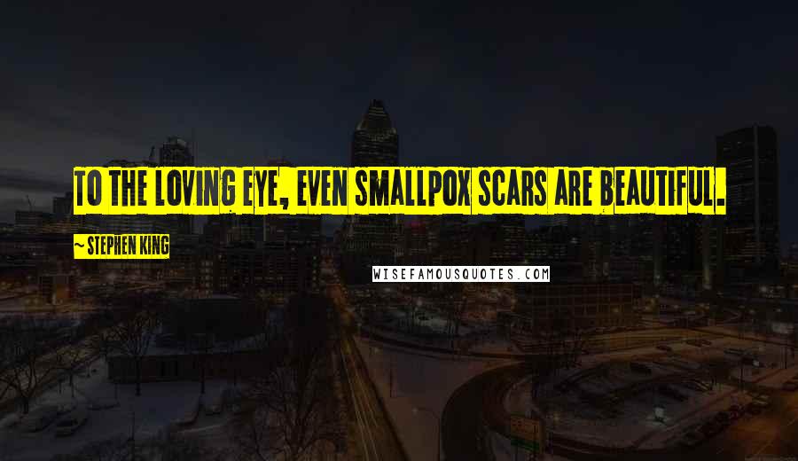 Stephen King Quotes: To the loving eye, even smallpox scars are beautiful.