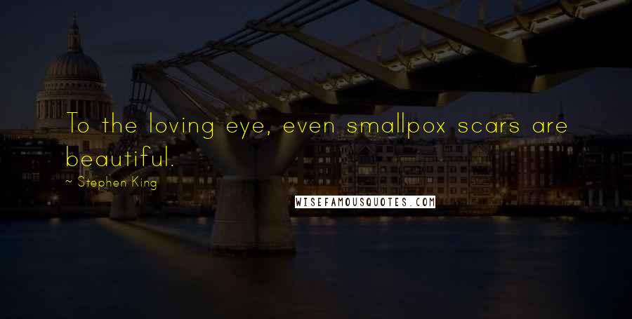 Stephen King Quotes: To the loving eye, even smallpox scars are beautiful.