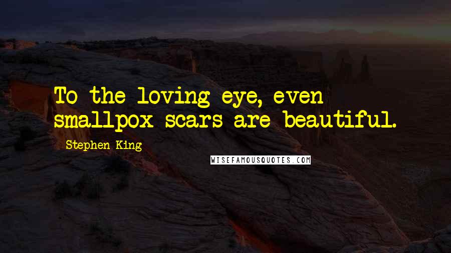 Stephen King Quotes: To the loving eye, even smallpox scars are beautiful.