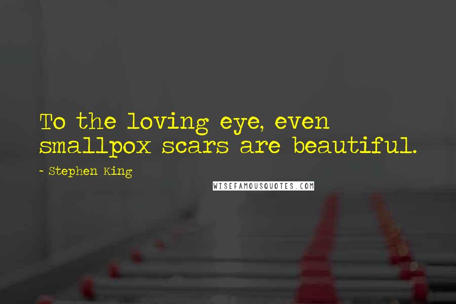 Stephen King Quotes: To the loving eye, even smallpox scars are beautiful.