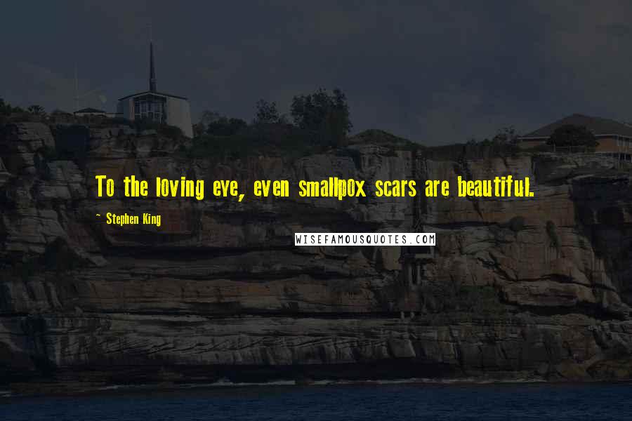 Stephen King Quotes: To the loving eye, even smallpox scars are beautiful.