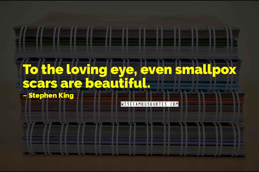 Stephen King Quotes: To the loving eye, even smallpox scars are beautiful.