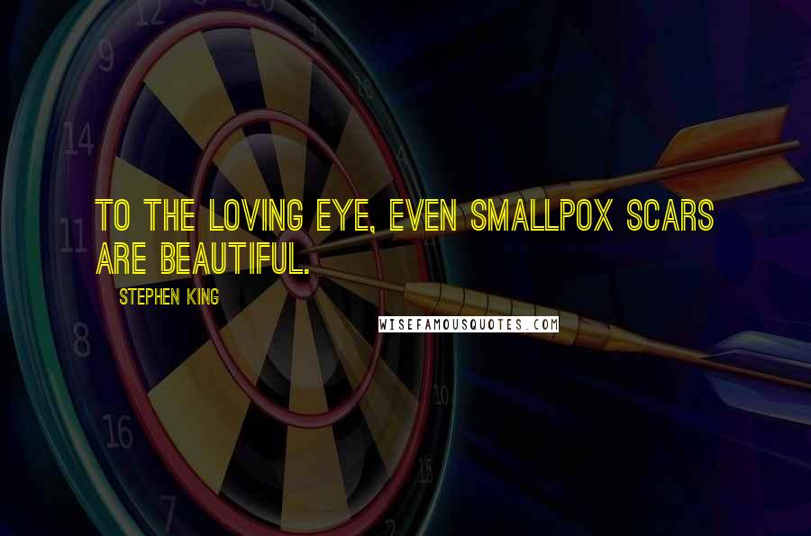 Stephen King Quotes: To the loving eye, even smallpox scars are beautiful.