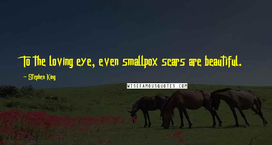 Stephen King Quotes: To the loving eye, even smallpox scars are beautiful.