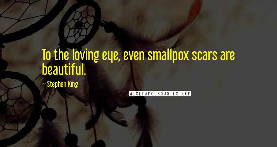 Stephen King Quotes: To the loving eye, even smallpox scars are beautiful.