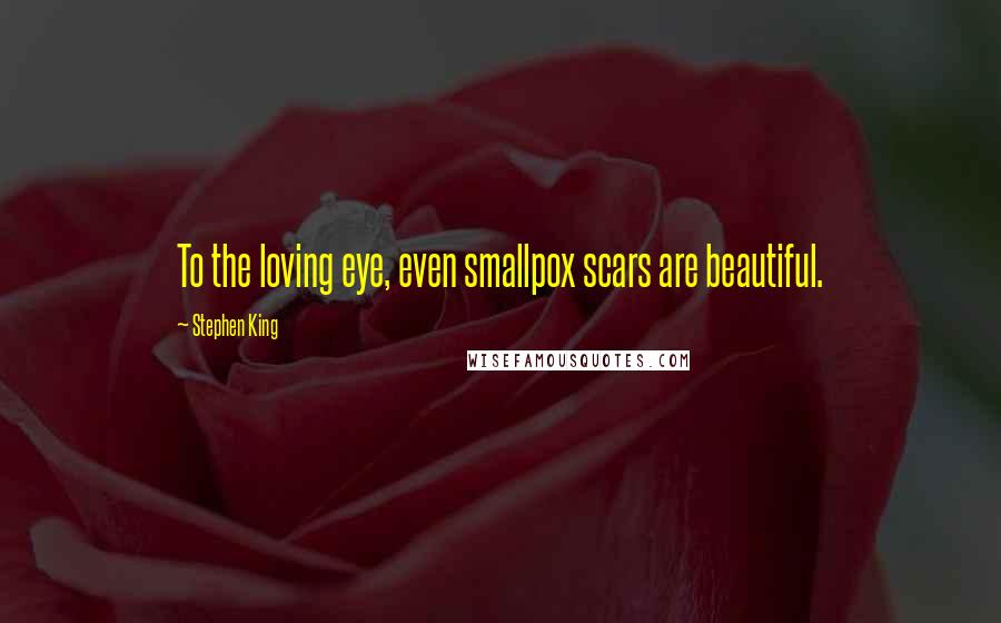 Stephen King Quotes: To the loving eye, even smallpox scars are beautiful.