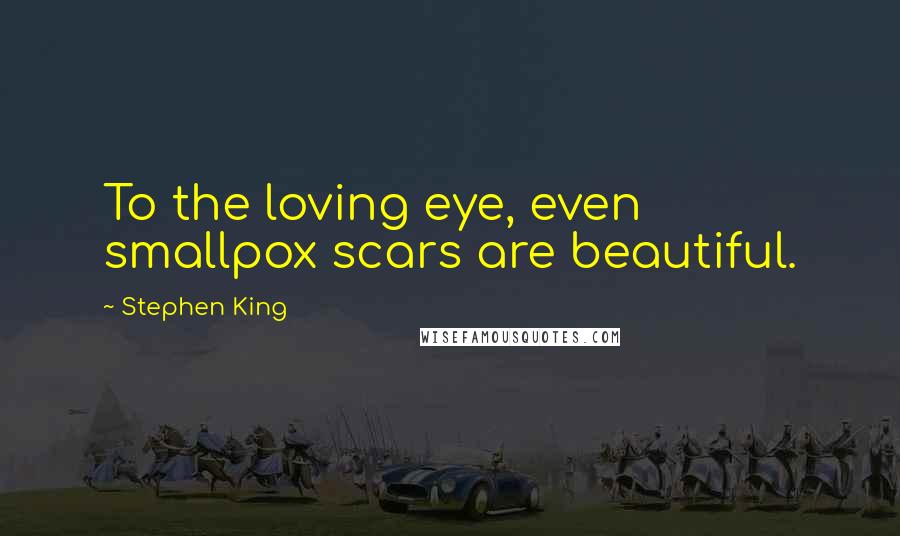 Stephen King Quotes: To the loving eye, even smallpox scars are beautiful.