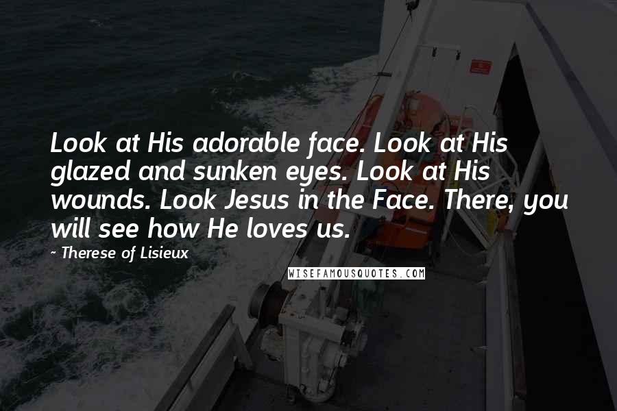 Therese Of Lisieux Quotes: Look at His adorable face. Look at His glazed and sunken eyes. Look at His wounds. Look Jesus in the Face. There, you will see how He loves us.