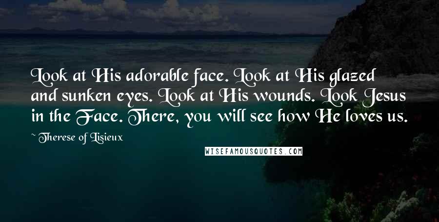 Therese Of Lisieux Quotes: Look at His adorable face. Look at His glazed and sunken eyes. Look at His wounds. Look Jesus in the Face. There, you will see how He loves us.