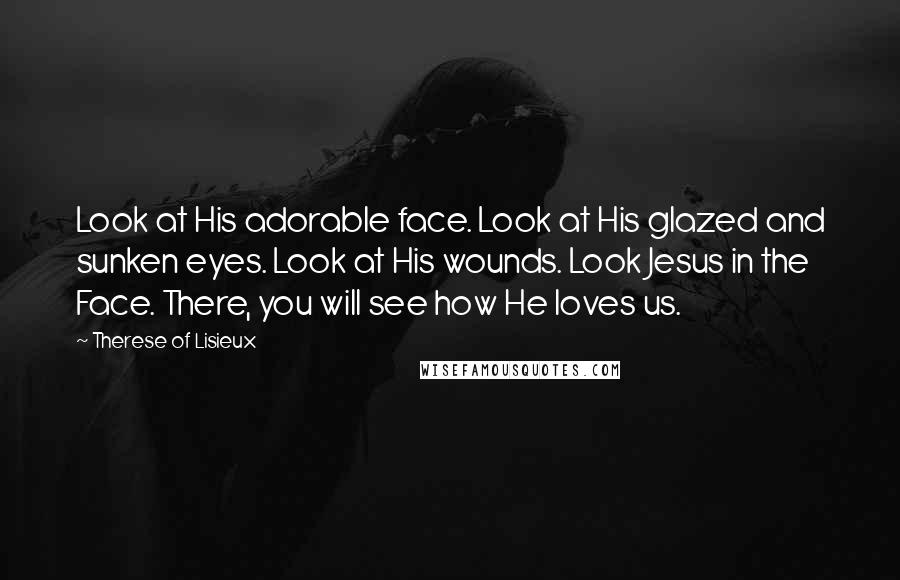 Therese Of Lisieux Quotes: Look at His adorable face. Look at His glazed and sunken eyes. Look at His wounds. Look Jesus in the Face. There, you will see how He loves us.