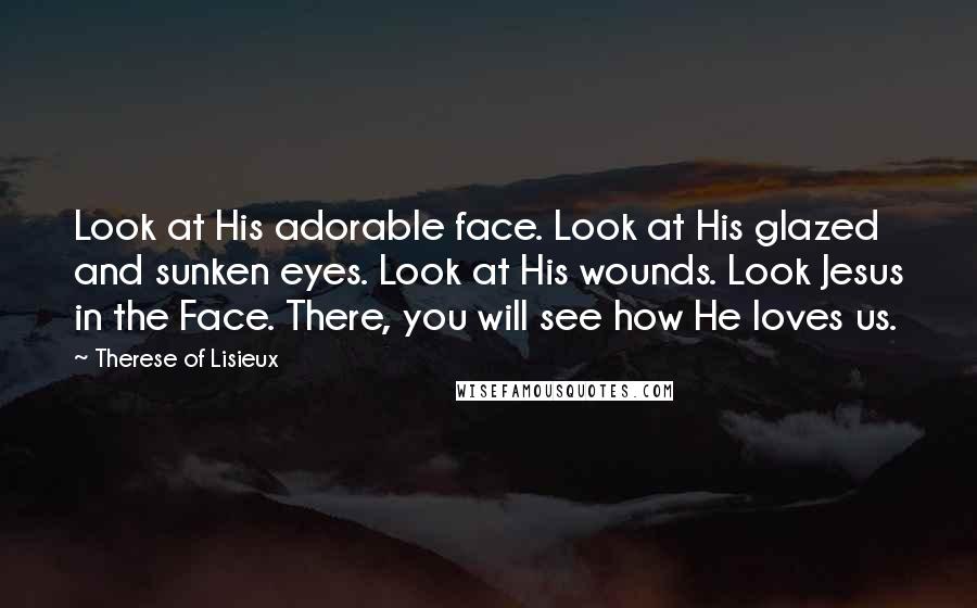 Therese Of Lisieux Quotes: Look at His adorable face. Look at His glazed and sunken eyes. Look at His wounds. Look Jesus in the Face. There, you will see how He loves us.