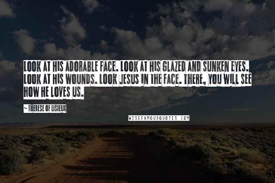 Therese Of Lisieux Quotes: Look at His adorable face. Look at His glazed and sunken eyes. Look at His wounds. Look Jesus in the Face. There, you will see how He loves us.